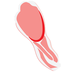 diet