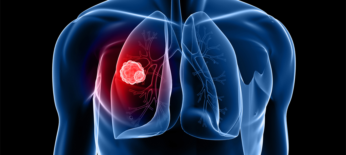 Diagram of lungs.