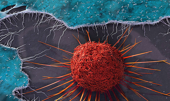 Cervical Cancer Cell