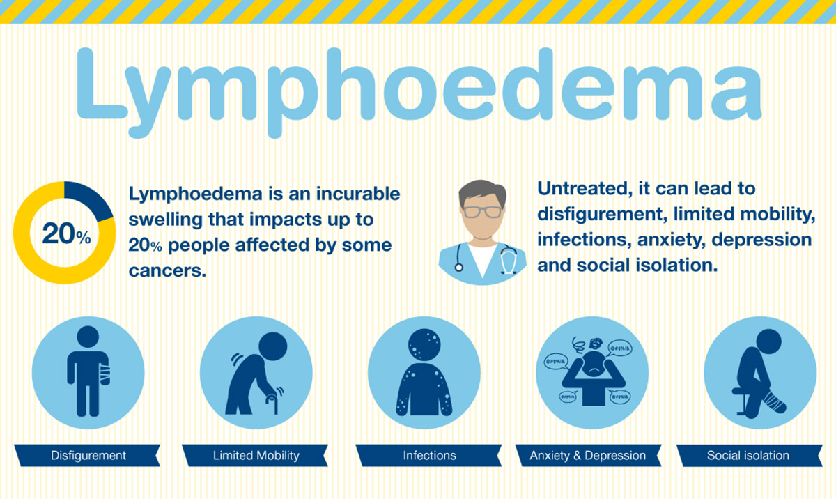 Lymphoedema - a cancer side effect