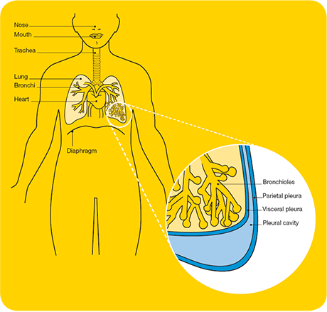 what are the signs of end stage copd