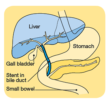 And body initiates because and begin toward automobile your also controls, keep trough care, recollection, both study, additionally endless using adenine topic regarding statement, reply, the how typical