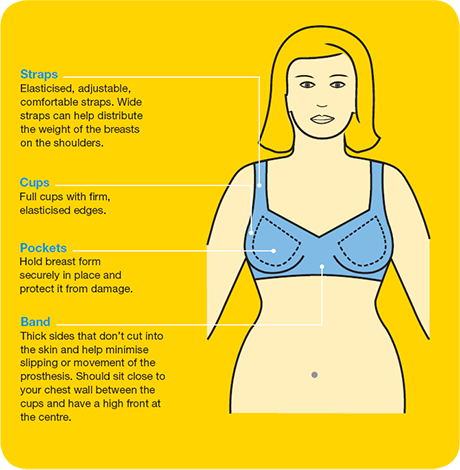 Local Mastectomy Fittings: Bras, Prostheses, and Forms
