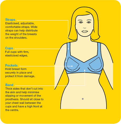 What Type of Bra Can Be Worn With an External Prosthesis?- A