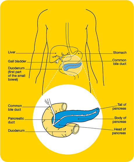 An image showing where the pancreas is located, just below the stomach, and the parts of the pancreas.