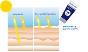 A diagram showing sunscreen blocking UVA and UVB rays