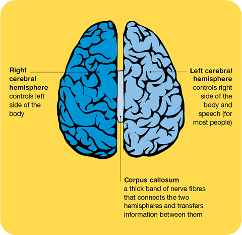 A top view of the brain, showing the right and left sides of the brain which control the opposite site of the body, and the corpus callosum in the middle connecting the two hemispheres