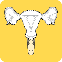 Total hysterectomy and bilateral salpingo-oophorectomy