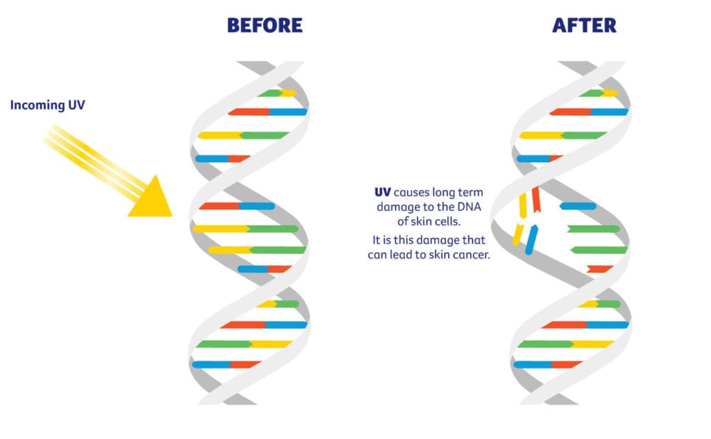 UV rays can damage the DNA in your skin cells, leading to skin cancers