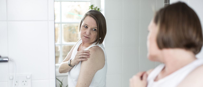 Woman checking her skin for melanoma cancer.