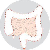 Proctocolectomy