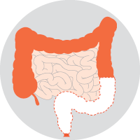 Ultra-low anterior resection