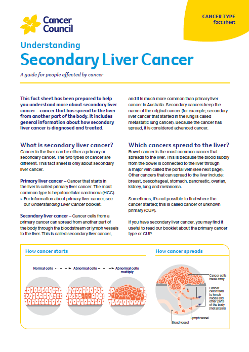Understanding Secondary liver cancer cover thumbnail