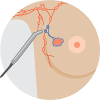 Handheld probe technique