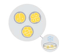 Step 4: Embryo freezing IVF