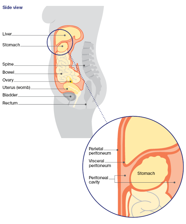 The abdomen and pelvis mesothelioma