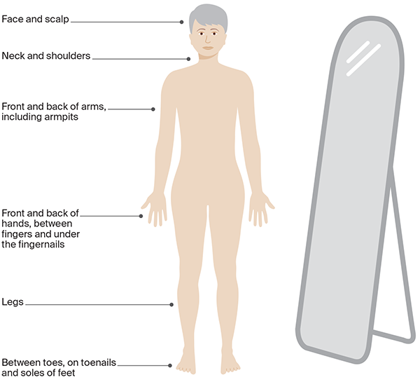 How to check your skin