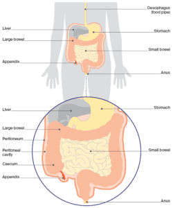 About Appendix Cancer & PMP | Cancer Council NSW