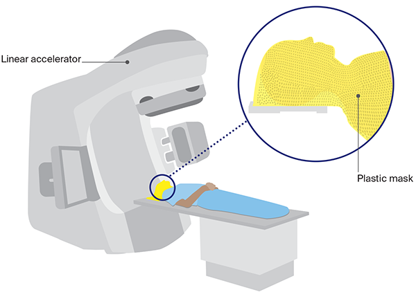 Diagram of a linear accelerator