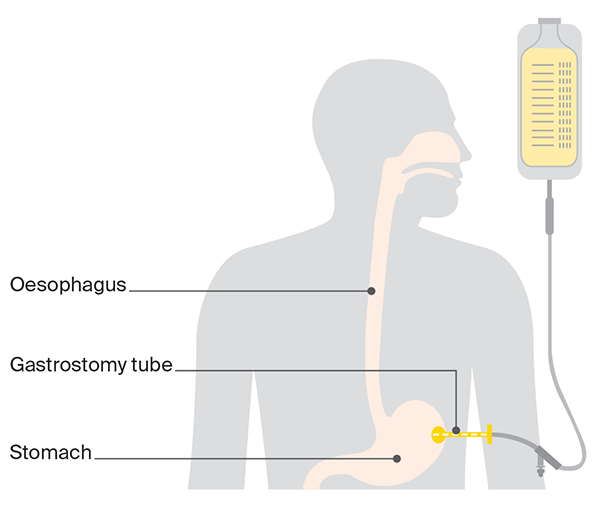 Diagram of long