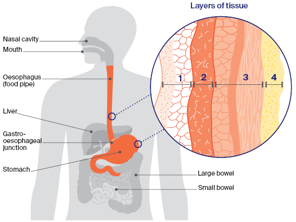 anatomical image of the stomach and oesophagus