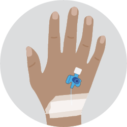 Diagram of Cannula This is a small plastic tube inserted into a vein in your arm or the back of your hand.
