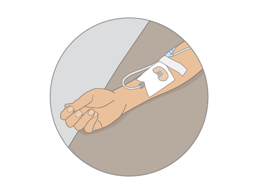 Image of someone getting chemotherapy through a vein in your arm.