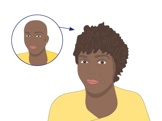 Image of a woman’s hair growing back.