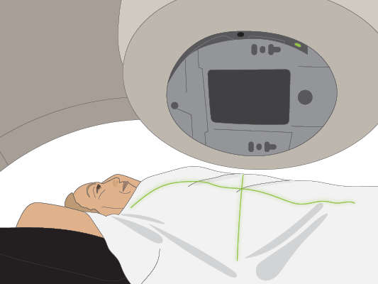 Image of person staying still while having radiation therapy.