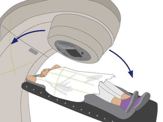 Image of radiation therapy machine moving around the patient.