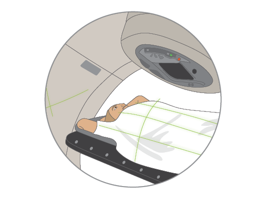 Image showing the machine send radiation beams to the part of the body where cancer was found.
