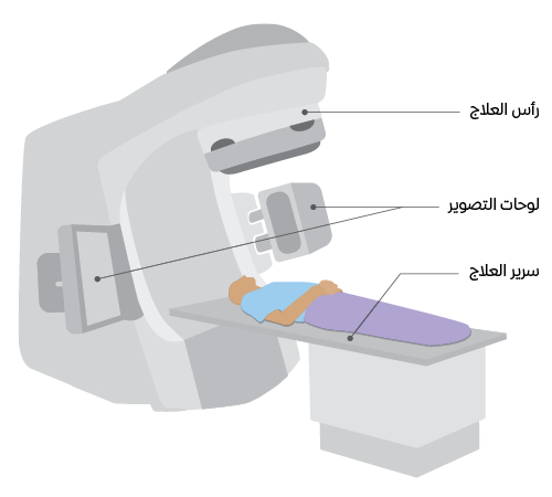 Image of a Linac machine with Arabic labels