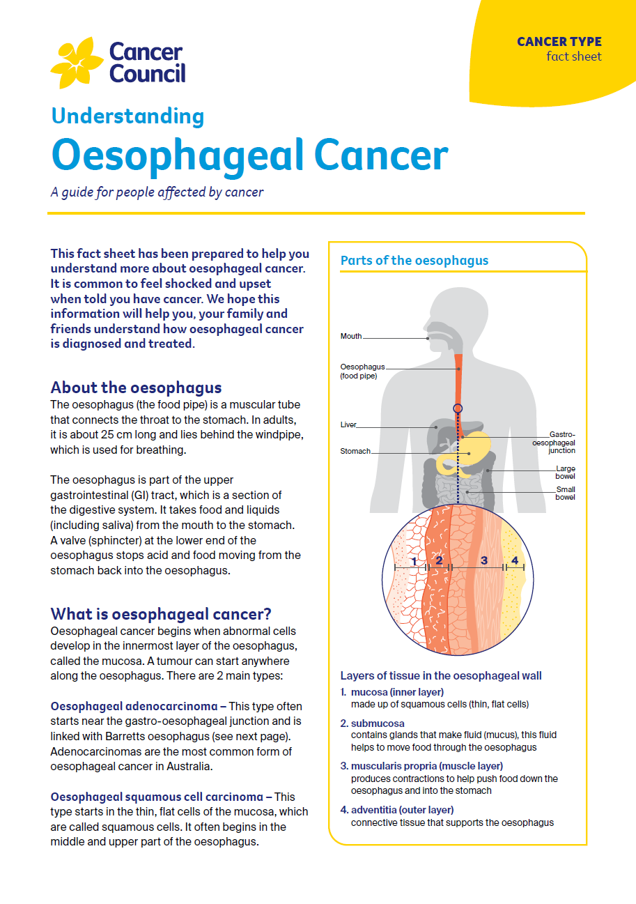 Understanding Oesophageal Cancer cover thumbnail